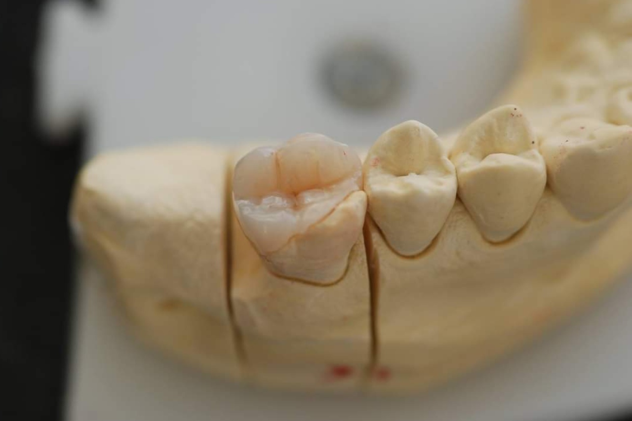 οδοντιατρος-περιστερι